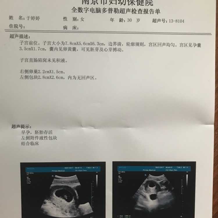上海代生选性别，上海第三代试管婴儿机构选性别排名,附上海助孕试管流程
