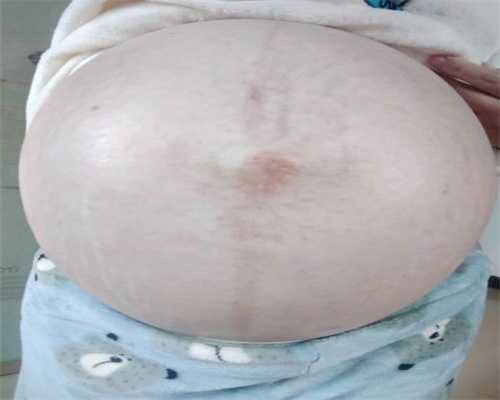 广州代孕产子费用问题,怀孕了长斑？孕期色斑重