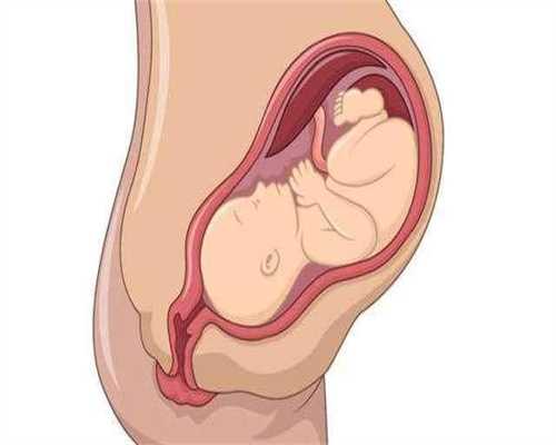 美国试管婴儿广州代孕的具体步骤,输卵管切除会