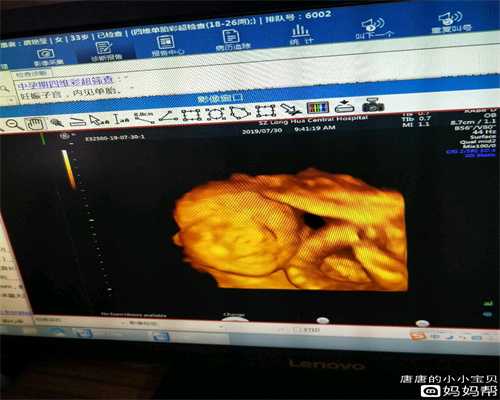 上海代理生一个孩子多少钱—胎教故事《会说话