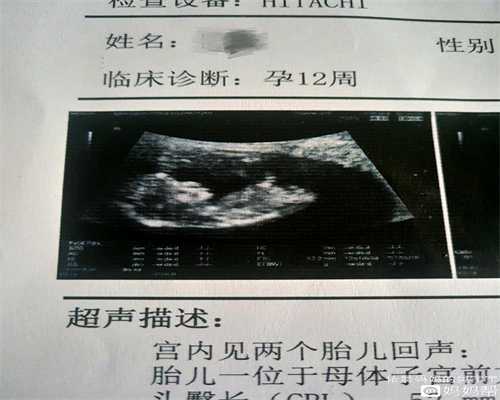 上海代孕中介官方网站-剖宫产可以保持体形吗