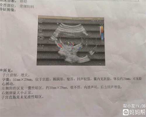 上海代孕多少钱-助孕婴儿补血口服液