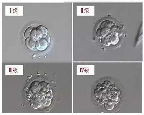 上海代孕地址-上海代孕的过程