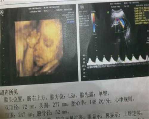 上海代孕哪里最靠谱,上海代孕哪里最靠谱,孕妇咳嗽影响胎儿吗 孕妇咳嗽厉害怎