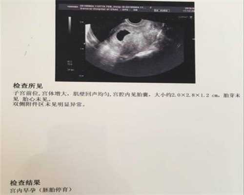 上海找个女人代孕生孩子-上海寻找代孕妈妈-上海找代孕疯狂生娃