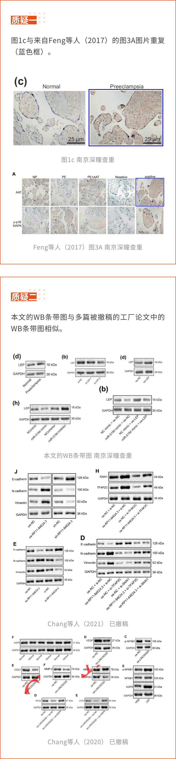 宁波市妇女儿童医院的sci论文因免疫组化图片重复被质疑