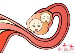 上海有要助孕的吗，上海试管婴儿有哪些技术？